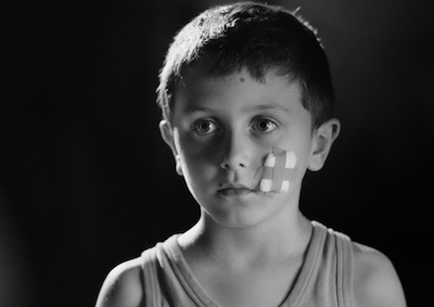 Giannis in the Cities A child with a bandage on their face.